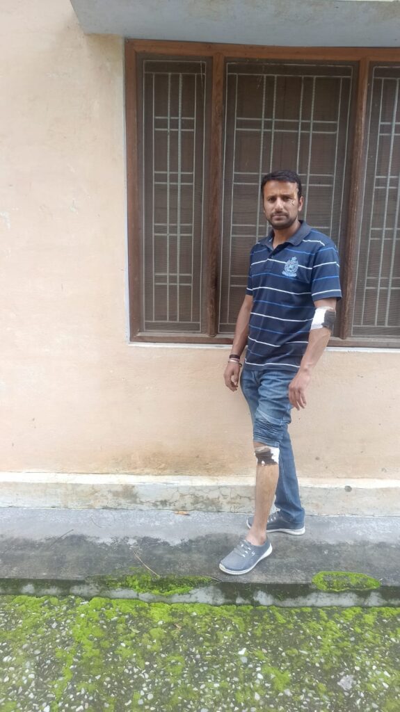 वन तस्कर को पकड़ने में घायल हुआ वनकर्मी, वन तस्कर मौके से फरार। NIU वन तस्कर को पकड़ने में घायल हुआ वनकर्मी, वन तस्कर मौके से फरार। NIU